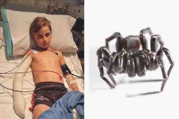 Un niño de 10 años es mordido por una de las arañas más venenosas del mundo